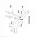 Fig. 20 - Methods for renal neuromodulation