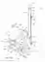 Fig. 05 - Stabilization apparatuses and methods for medical procedures