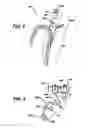 Fig. 04 - Surgical device with overload mechanism
