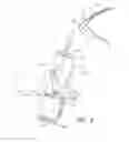 Fig. 11 - SURGICAL DEVICE CLEANING TOOL AND COLLECTOR