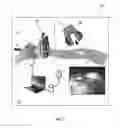 Fig. 02 - System and method for intraoperative joint contact mechanics measurement