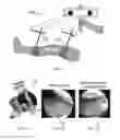 Fig. 11 - System and method for intraoperative joint contact mechanics measurement