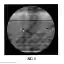 Fig. 04 - Imaging fiducial markers and methods