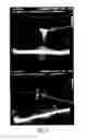 Fig. 06 - Imaging fiducial markers and methods
