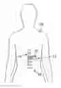 Fig. 01 - Medical Procedure Localizing Aid