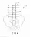 Fig. 03 - Medical Procedure Localizing Aid
