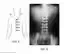 Fig. 04 - Medical Procedure Localizing Aid