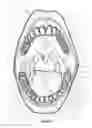 Fig. 05 - Dental oral shield device and system