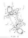 Fig. 02 - Dental repositioning device