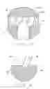 Fig. 05 - Dental repositioning device