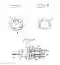 Fig. 02 - Implant arrangement with an internal socket for a turning tool