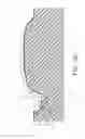 Fig. 03 - MOLDED DENTURE AND METHOD AND APPARATUS OF MAKING SAME