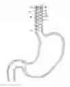 Fig. 01 - Esophageal sleeve
