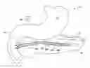 Fig. 01 - Pancreatic stent with drainage feature