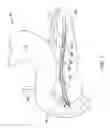 Fig. 02 - Pancreatic stent with drainage feature
