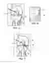 Fig. 03 - METHODS AND SYSTEMS FOR FORMING UNICOMPARTMENTAL AND UNICONDYLAR KNEE RESURFACING IN CONJUNCTION WITH CRUCIATE LIGAMENT REPLACEMENT CONCOMITANTLY