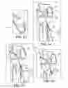 Fig. 07 - METHODS AND SYSTEMS FOR FORMING UNICOMPARTMENTAL AND UNICONDYLAR KNEE RESURFACING IN CONJUNCTION WITH CRUCIATE LIGAMENT REPLACEMENT CONCOMITANTLY