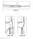 Fig. 08 - METHODS AND SYSTEMS FOR FORMING UNICOMPARTMENTAL AND UNICONDYLAR KNEE RESURFACING IN CONJUNCTION WITH CRUCIATE LIGAMENT REPLACEMENT CONCOMITANTLY
