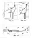 Fig. 10 - METHODS AND SYSTEMS FOR FORMING UNICOMPARTMENTAL AND UNICONDYLAR KNEE RESURFACING IN CONJUNCTION WITH CRUCIATE LIGAMENT REPLACEMENT CONCOMITANTLY