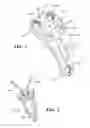 Fig. 02 - Muscle tissue anchor plate
