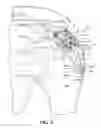Fig. 06 - Muscle tissue anchor plate