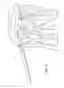 Fig. 08 - Muscle tissue anchor plate