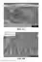 Fig. 17 - NANOMATERIALS FOR THE INTEGRATION OF SOFT INTO HARD TISSUE