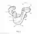 Fig. 03 - GRAFT FIXATION