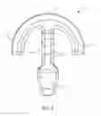Fig. 04 - GRAFT FIXATION