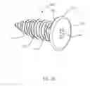 Fig. 14 - GRAFT FIXATION