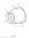 Fig. 18 - GRAFT FIXATION