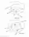 Fig. 35 - GRAFT FIXATION
