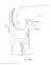 Fig. 37 - GRAFT FIXATION
