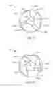 Fig. 05 - Girth expanding penile prosthesis cylinder