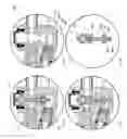 Fig. 11 - PUMP FOR AN IMPLANTABLE PENILE PROSTHESIS