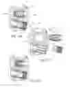 Fig. 15 - PUMP FOR AN IMPLANTABLE PENILE PROSTHESIS