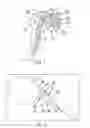 Fig. 02 - Method for optimization of joint arthroplasty component design