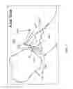 Fig. 07 - Method for optimization of joint arthroplasty component design