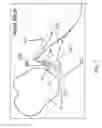 Fig. 07 - Method for optimization of joint arthroplasty component design