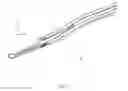 Fig. 31 - Artificial cervical and lumbar discs, disc plate insertion gun for performing sequential single plate intervertebral implantation enabling symmetric bi-disc plate alignment for interplate mobile core placement