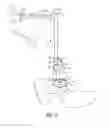 Fig. 03 - ACETABULAR EXPLANT APPARATUS, SYSTEM, AND METHOD