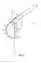 Fig. 07 - ACETABULAR EXPLANT APPARATUS, SYSTEM, AND METHOD