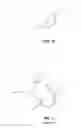 Fig. 11 - Prosthesis positioning systems and methods