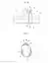 Fig. 13 - MEDICAL STENT
