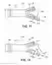 Fig. 12 - Bifurcated endovascular prosthesis having tethered contralateral leg