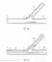 Fig. 06 - Multi-stent and multi-balloon apparatus for treating bifurcations and methods of use