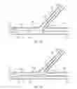 Fig. 09 - Multi-stent and multi-balloon apparatus for treating bifurcations and methods of use