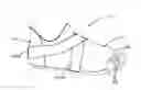 Fig. 01 - Flexible Wearable Foot Sling