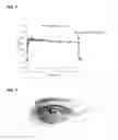 Fig. 05 - AUTONOMOUS TEMPERATURE CONTROL OF HEATING DEVICES FOR MEDICAL TREATMENT
