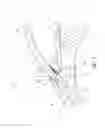 Fig. 03 - Ocular system with anchoring implant and therapeutic agent